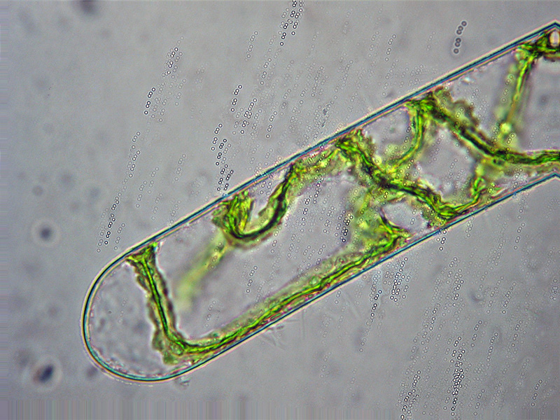 Dove finisce la Spirogyra...